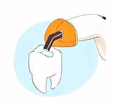 牙医大喊 冤枉 ,补牙后出现牙痛,这不表示你的牙没治好...