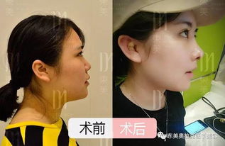 还有哪些方法能让塌鼻子、大饼脸的人变好看