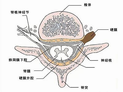 脊髓空洞症患者饮食方面有什么需要注意的呢