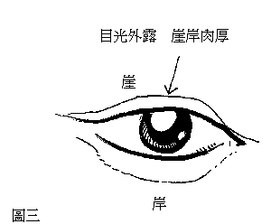 这种人面相,大难不死必有后福 