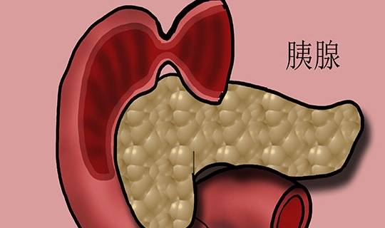 什么原因会导致胰腺癌的出现,为何它的死亡率非常高