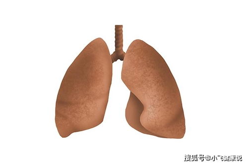戒烟后,肺还能变回原样吗 多久能恢复 医生告诉你答案