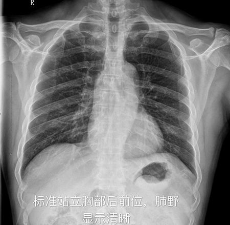 为什么放射科床旁X线片检查不能作为常规项目