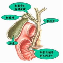 ℃慢性胆囊炎症状是什么呢?℃胆囊炎吃什么好呢?胆囊炎的治疗方法应以药物为主