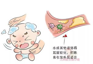 掏耳朵竟伤到宝宝鼓膜,这等小事的风险你承受不起