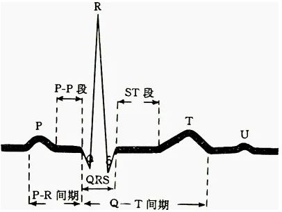 心电图st段正常值图解图片