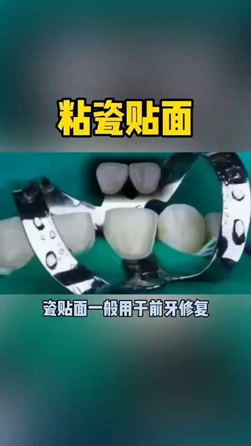 牙黄 牙齿缺损一小块 