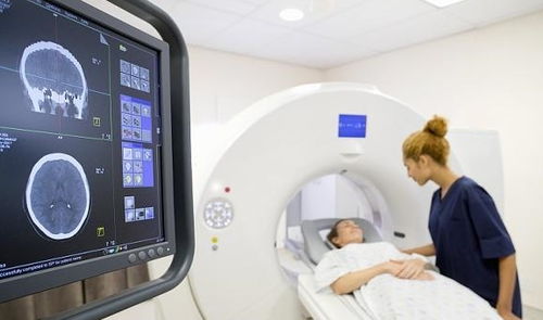 什么是增强CT 相对于普通CT,增强CT有这4个优势