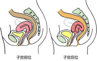 子宫后位腰疼怎样治疗啊？怀孕初期出现这种情况该怎么办好？有什么好的办法可以改善吗？