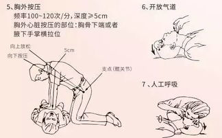 每人必学的冠心病家庭急救法