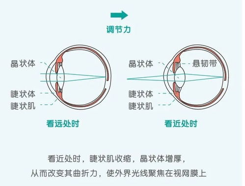 国家发布 儿童青少年防控近视手册 ,原来这么多重点都被我们忽视了