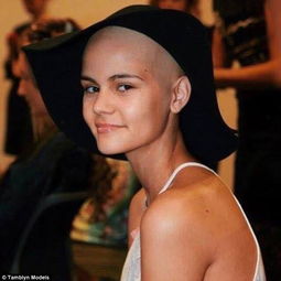 15岁少女患罕见癌症 为模特梦坚持 