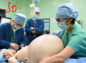 六旬老人 怀孕 肚大如鼓,有70斤重 医生 三胎也没这么大肚子