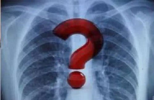 为什么有的医生要求肺结节患者三个月复查一次如果复查后又让本人随时复诊，这说明了什么问题