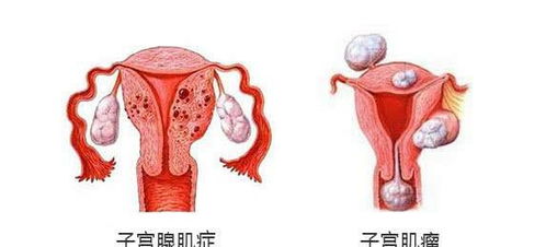 卵巢保养(卵巢保养的作用和好处)