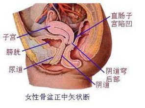 盆腔积液得有效治疗有哪些