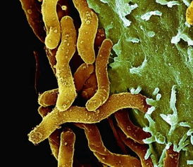 幽门螺杆菌的四种常见检查方法是什么？