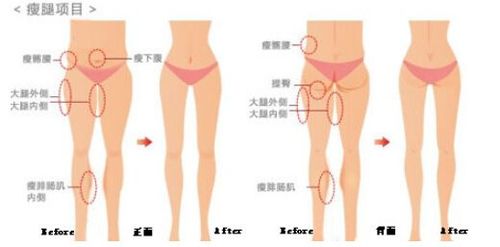 大腿会瘦的冷知识 大腿要瘦的征兆