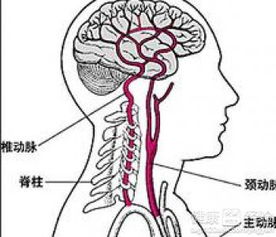 贫血脑供血不足可以做无痛人流吗(脑供血不足可以要小孩吗)