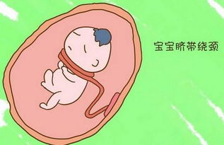 原创孕晚期，孕妈若有3个“坏习惯”，或许会造成宝宝“脐带绕颈”