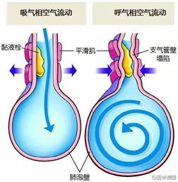 呼吸系统美图篇,美翻了 临床必备