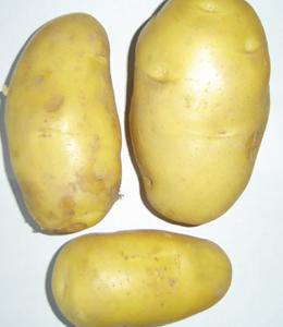 吃土豆能减肥吗 