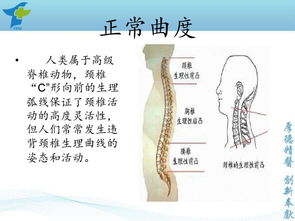 颈椎反弓图片 信息阅读欣赏 信息村 K0w0m Com