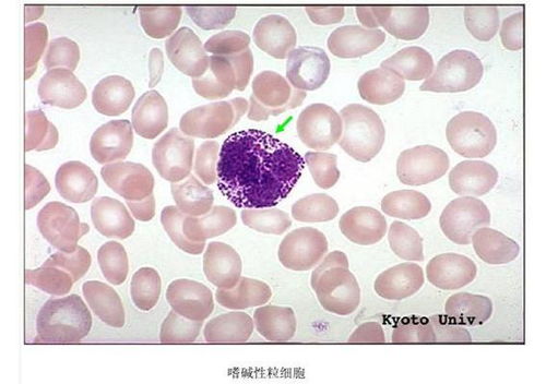 嗜碱细胞1.80,嗜碱细胞绝对值