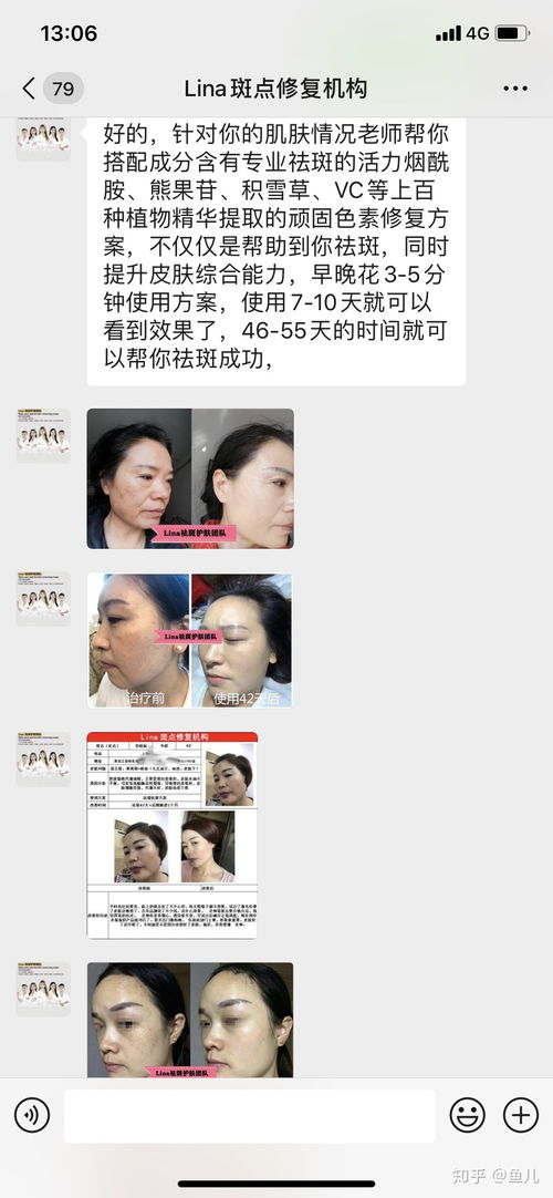 千万别相信网上微信上抖音上说的私人定制方案一两个月可以祛斑,这是诈骗团伙谁相信谁就上当 