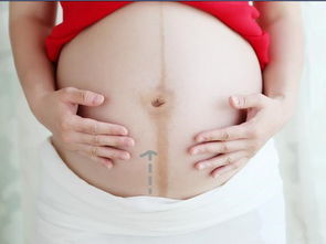原创孕妇肚子上的黑线，可以判断胎儿性别？别傻了，它的作用是这个
