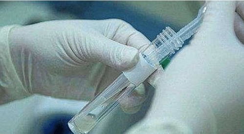无良医生 往试管灌入自己的精液,导致众多女患者怀孕共生58子