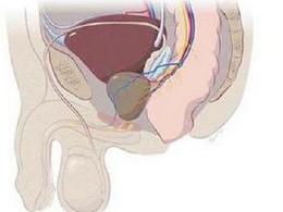 前列腺囊肿能过性生活吗-图1