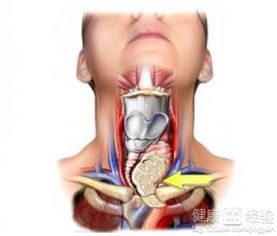 甲状腺癌根治术，甲状腺癌能够治愈吗