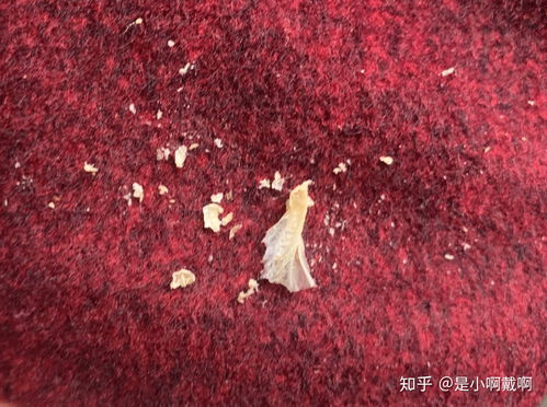 大家都挖出过什么形状的鼻屎或耳屎 