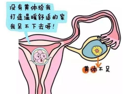 一天接了3个急诊,都是黄体破裂,黄体到底是什么呢 女性了解下