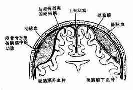 硬脑膜外血肿怎么治疗