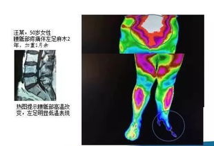 红外热成像检查：做到“看得清、检得准、治得好