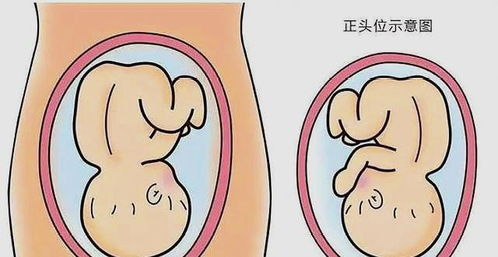 孕晚期,胎儿若在子宫内是这些姿势,或许遭遇难产