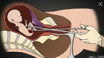 原创人流时胎儿会疼吗？看完这4种胎儿死法，这辈子都不会去人流！
