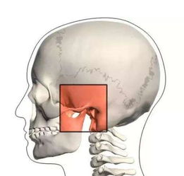 颞下颌关节紊乱综合征 搜狗百科 
