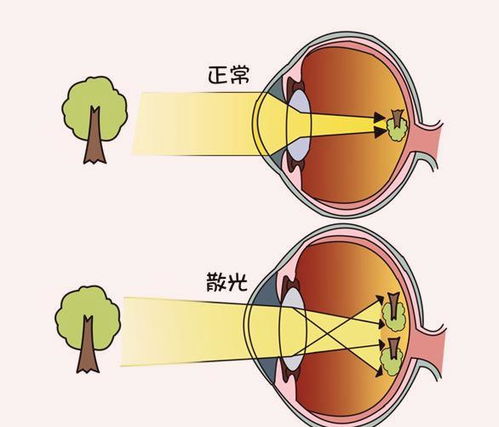 带娃复查视力,医生说娃视力保持很好 爱眼护眼 123 做起来