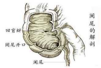 阑尾炎疼痛怎么缓解