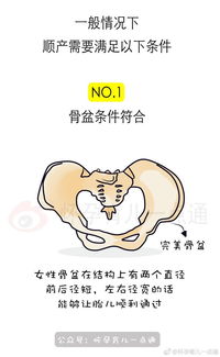 顺产需要什么条件 