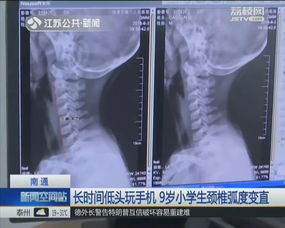 9岁小学生竟查出颈椎病,家长要这样提醒孩子