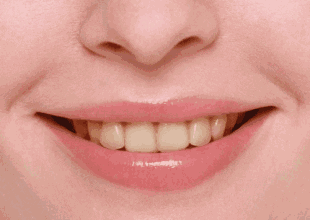 牙齿美白心得 白了10个色号,笑起来好看100倍 