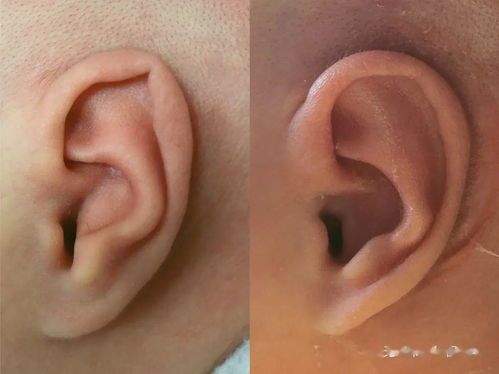 耳廓是指哪个位置图片