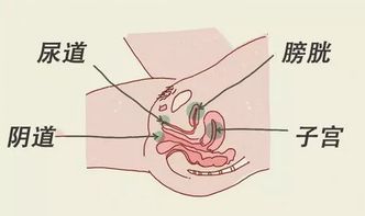 尿路感染是种让人尴尬的痛,它比你想象中更容易发 