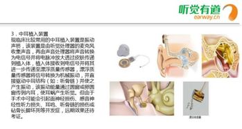 采用骨导技术的助听器有哪些公司？要国内的