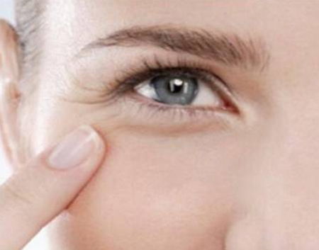 眼部皱纹怎么去除 消除眼部皱纹的好办法 