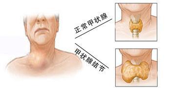 揭秘头颈部热成像检查：新一代健康诊断神器？